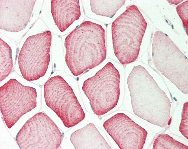 Human Skeletal Muscle: Formalin-Fixed, Paraffin-Embedded (FFPE)
