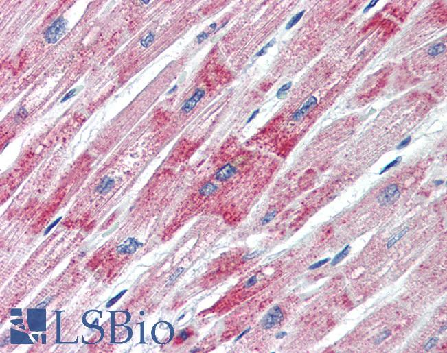Anti-DBP antibody IHC of human heart. Immunohistochemistry of formalin-fixed, paraffin-embedded tissue after heat-induced antigen retrieval. Antibody LS-B3479 concentration 5 ug/ml.