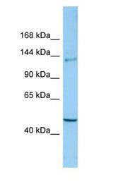 CLASP2 antibody Western Blot of ACHN.