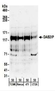 Detection of Mouse DAB2IP by Western Blot. Samples: Whole cell lysate (50 ug) from TCMK-1, Renca, 4T1, and CT26.WT cells. Antibodies: Affinity purified rabbit anti-DAB2IP antibody used for WB at 0.1 ug/ml. Detection: Chemiluminescence with an exposure time of 3 minutes.