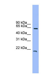 DACH1 antibody LS-C116908 Western blot of Jurkat lysate.