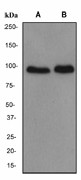 Western blot analysis on (A) MCF-7 and (B) HeLa cell lysate using anti-Dachshund1 antibody (LS-C105436), dilution 1:1000.