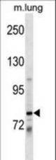 DACH1 Antibody western blot of mouse lung tissue lysates (35 ug/lane). The DACH1 antibody detected the DACH1 protein (arrow).