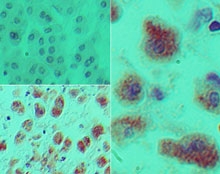 IHC of Dach1 in formalin-fixed, paraffin-embedded human kidney tissue using an isotype control (top left) and LS-C148748 (bottom left, right) at 5 ug/ml.