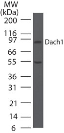 Western blot of Dach1 in human placenta lysate using LS-C148748 at 5 ug/ml.