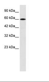 Jurkat Cell Lysate