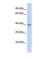 Western blot of Human MCF7. DACH2 antibody dilution 1.0 ug/ml.