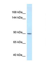DACT1 antibody LS-C145635 Western blot of 293T Cell lysate. Antibody concentration 1 ug/ml.