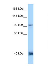 DACT1 antibody LS-C146119 Western blot of 435S Cell lysate. Antibody concentration 1 ug/ml.