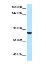 DACT1 antibody LS-C145968 Western blot of HepG2 Cell lysate. Antibody concentration 1 ug/ml.