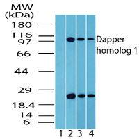 Western blot of Dapper homolog 1inbrain lysate. Lane1 shows pre-immune sera. Lanes 2, 3 and 4 show LS-B7941 tested on human brain (1 ug/ml), mouse brain (0.5 ug/ml) and rat brain (0.5 ug/ml) lysate.