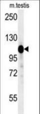DACT1 Antibody western blot of mouse testis tissue lysates (15 ug/lane). The DACT1 antibody detected DACT1 protein (arrow).