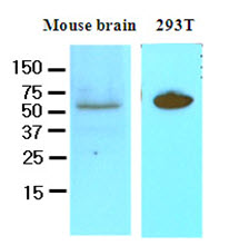Cell lysates of mouse brain and 293T (50 ug) were resolved by SDS-PAGE, transferred to NC membrane and probed with anti-human DACT3 (1:250). Proteins were visualized using a goat anti-mouse secondary antibody conjugated to HRP and an ECL detection system.