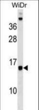 DAD1 Antibody western blot of WiDr cell line lysates (35 ug/lane). The DAD1 antibody detected the DAD1 protein (arrow).