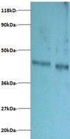 Western blot of Dolichyl-diphosphooligosaccharide-protein glycosyltransferase subunit DAD1 antibody at 2 ug/ml. Lane 1: EC109 whole cell lysate. Lane 2: 293T whole cell lysate. Secondary: Goat polyclonal to Rabbit IgG at 1:15000 dilution. Predicted band size: 12. 4 kDa. Observed band size: 40 kDa.