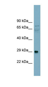 DAG1 / Dystroglycan antibody LS-C111099 Western blot of Fetal Stomach lysate.