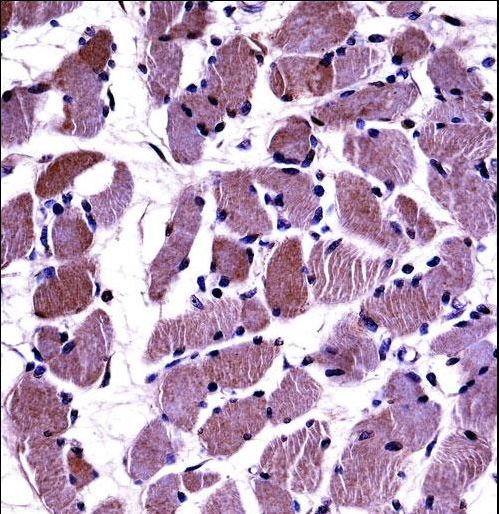 DAG1 Antibody immunohistochemistry of formalin-fixed and paraffin-embedded human skeletal muscle followed by peroxidase-conjugated secondary antibody and DAB staining.