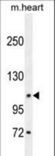 DAGLA Antibody western blot of mouse heart tissue lysates (35 ug/lane). The DAGLA antibody detected the DAGLA protein (arrow).