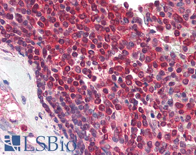Anti-DAGLA antibody IHC of human spleen. Immunohistochemistry of formalin-fixed, paraffin-embedded tissue after heat-induced antigen retrieval. Antibody LS-B3123 concentration 5 ug/ml.