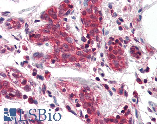 Anti-DAGLA antibody IHC of human breast. Immunohistochemistry of formalin-fixed, paraffin-embedded tissue after heat-induced antigen retrieval. Antibody LS-B3123 concentration 5 ug/ml.