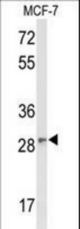 Western blot of DAGLB Antibody in MCF-7 cell line lysates (35 ug/lane). DAGLB (arrow) was detected using the purified antibody;