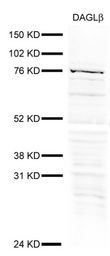 Immunoblot of DAGL-alpha using antibody at 1:100 in 40 ug of rat brain membranes, developed using the ECL technique.