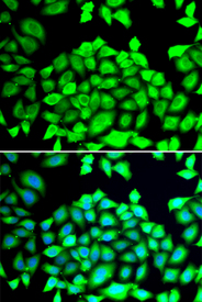 Immunofluorescence blot of HeLa cell using CLCN7 antibody. Blue: DAPI for nuclear staining.