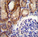 CLCN7 Antibody immunohistochemistry of formalin-fixed and paraffin-embedded human kidney tissue followed by peroxidase-conjugated secondary antibody and DAB staining.
