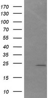 HEK293T cells were transfected with the pCMV6-ENTRY control (Left lane) or pCMV6-ENTRY DAND5 (Right lane) cDNA for 48 hrs and lysed. Equivalent amounts of cell lysates (5 ug per lane) were separated by SDS-PAGE and immunoblotted with anti-DAND5.