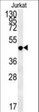 DAO Antibody western blot of Jurkat cell line lysates (35 ug/lane). The DAO antibody detected the DAO protein (arrow).