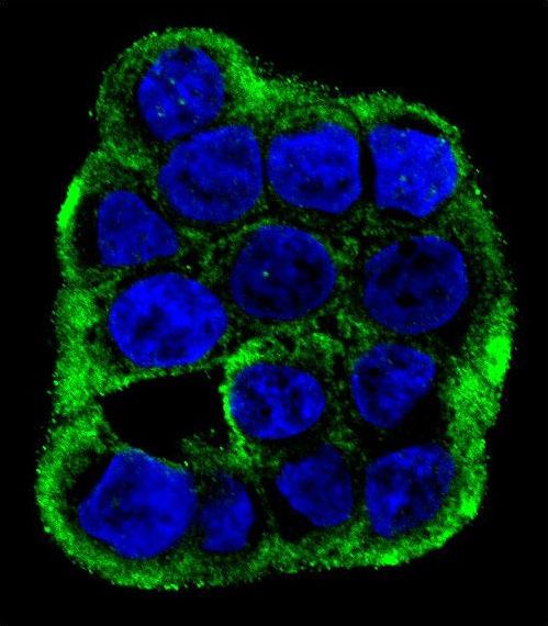 Confocal immunofluorescent of CLCN7 Antibody with WiDr cell followed by Alexa Fluor 488-conjugated goat anti-rabbit lgG (green). DAPI was used to stain the cell nuclear (blue).