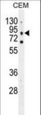 CLCN7 Antibody western blot of CEM cell line lysates (35 ug/lane). The CLCN7 antibody detected the CLCN7 protein (arrow).