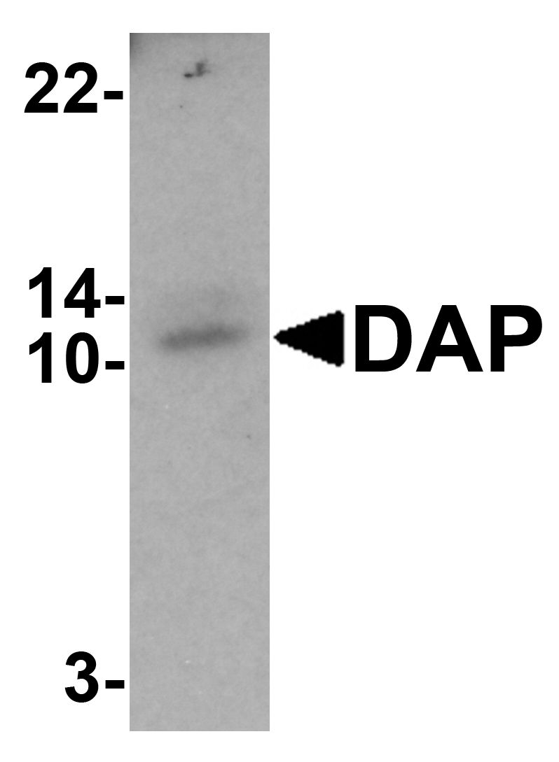 Western blot analysis of DAP in human small intestine tissue lysate with DAP antibody at 1 ug/ml.