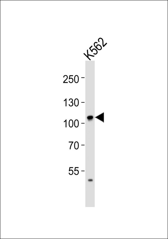 Western blot of lysate from K562 cell line with EIF4G2 Antibody. Antibody was diluted at 1:1000. A goat anti-rabbit IgG H&L (HRP) at 1:5000 dilution was used as the secondary antibody. Lysate at 35 ug.