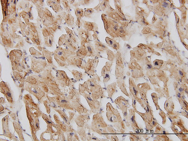 Immunoperoxidase of monoclonal antibody to EIF4G2 on formalin-fixed paraffin-embedded human heart. [antibody concentration 3 ug/ml].