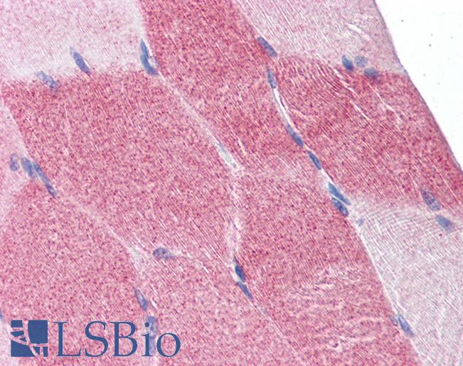 Anti-EIF4G2 antibody IHC of human skeletal muscle. Immunohistochemistry of formalin-fixed, paraffin-embedded tissue after heat-induced antigen retrieval. Antibody LS-B4208 concentration 10 ug/ml.
