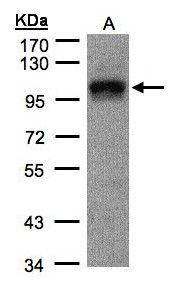Sample(30 g of whole cell lysate). A: A431. 7.5% SDS PAGE. EIF4G2 antibody diluted at 1:1000.