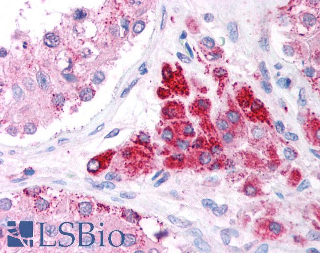 Anti-EIF4G2 antibody IHC of human testis. Immunohistochemistry of formalin-fixed, paraffin-embedded tissue after heat-induced antigen retrieval. Antibody LS-B944 concentration 5 ug/ml.