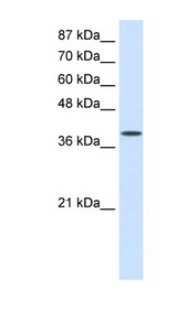 EIF4G2 antibody LS-B944 Western blot of HepG2 cell lysate.