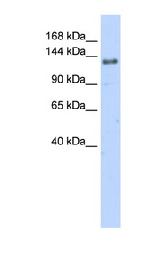 EIF4G2 antibody LS-C101837 Western blot of 721_B cell lysate.