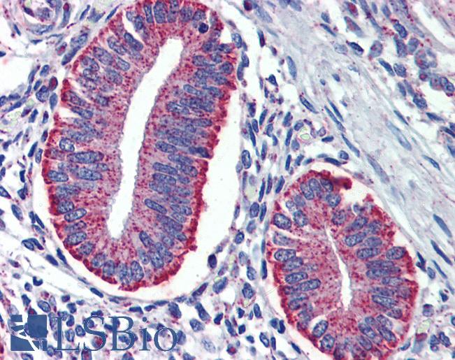 Anti-TYROBP / DAP12 antibody IHC of human uterus. Immunohistochemistry of formalin-fixed, paraffin-embedded tissue after heat-induced antigen retrieval. Antibody LS-B3718 concentration 3 ug/ml.