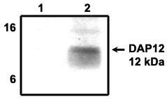 Immunoprecipitation using DAP12 antibody on MHC class I (1) and NKp44 (2) positive cells.
