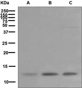 Western blot analysis on (A) peripheral blood leukocytes, (B) human placenta, and (C) peripheral blood mononuclear cell lysates using anti-DAP12 antibody.