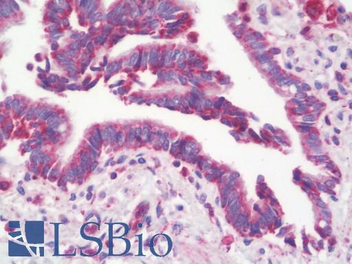 Anti-DAP12 antibody IHC staining of human lung. Immunohistochemistry of formalin-fixed, paraffin-embedded tissue after heat-induced antigen retrieval. Antibody LS-B10432 dilution 1:100.