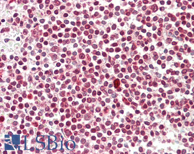 Anti-DAPK1 / DAP Kinase antibody IHC staining of human spleen. Immunohistochemistry of formalin-fixed, paraffin-embedded tissue after heat-induced antigen retrieval. Antibody LS-B11327 concentration 5 ug/ml.