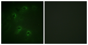 Immunofluorescence of COS7 cells, using DAPK1 Antibody. The sample on the right was incubated with synthetic peptide.