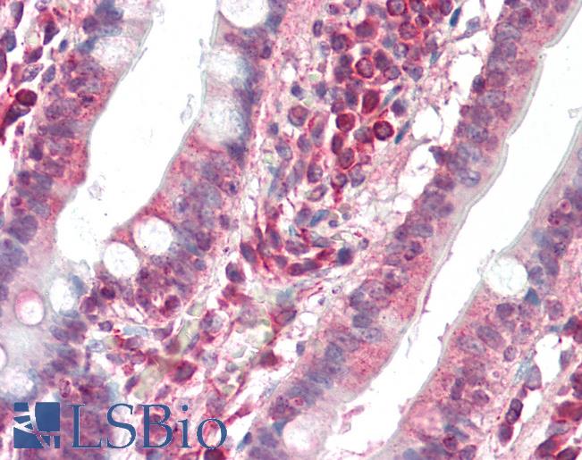 Human Small Intestine: Formalin-Fixed, Paraffin-Embedded (FFPE)