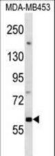 Mouse Dapk1 Antibody western blot of MDA-MB453 cell line lysates (35 ug/lane). The Dapk1 antibody detected the Dapk1 protein (arrow).