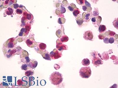Anti-CLCF1 antibody IHC of human lung, macrophages. Immunohistochemistry of formalin-fixed, paraffin-embedded tissue after heat-induced antigen retrieval. Antibody LS-B8220 dilution 5 ug/ml.