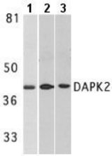 DAPK 2 Antibody - Western blot of DAP Kinase 2 in A431 whole cell lysate (lane 1), mouse spleen lysate (lane 2) and rat kidney lysate (lane 3).
